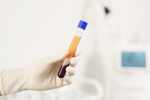 Study confirms accurate measurement results of sodium and potassium