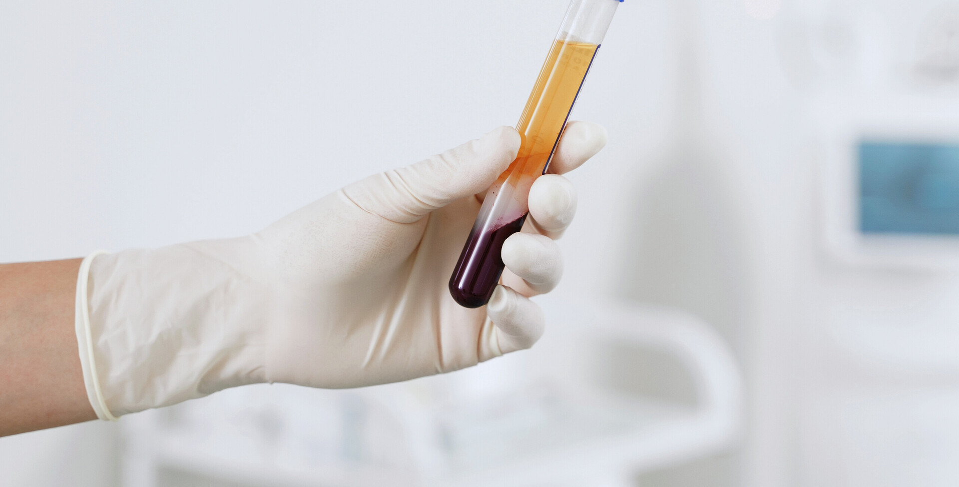 Comparative Study of EXIAS and MEON on direct and indirect Ion.selective electrode methods